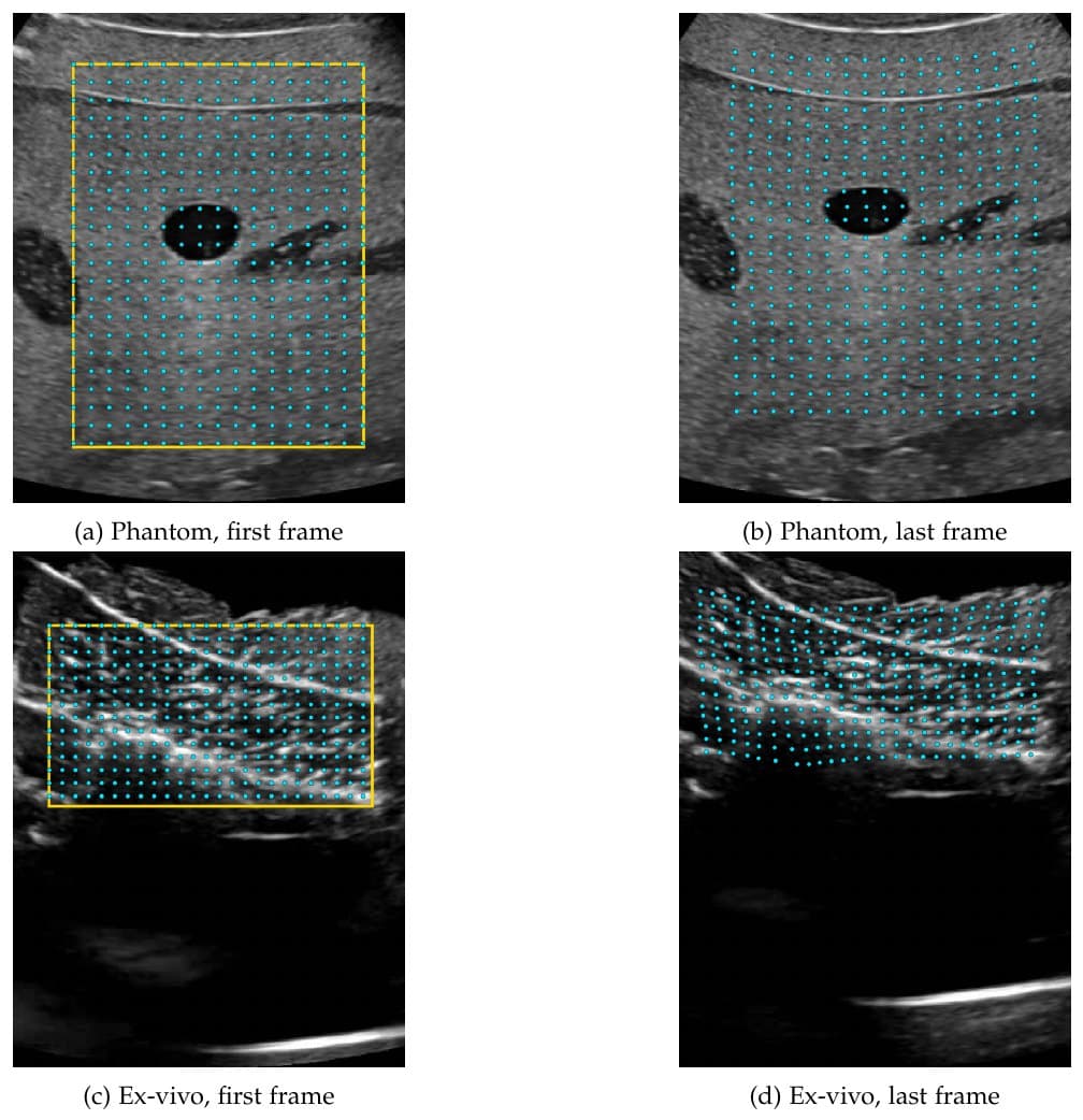 Dense-grid landmark annotation: a regular grid of cyan points inside a drawn region of interest, tracked from first to last frame on phantom and ex-vivo clips.