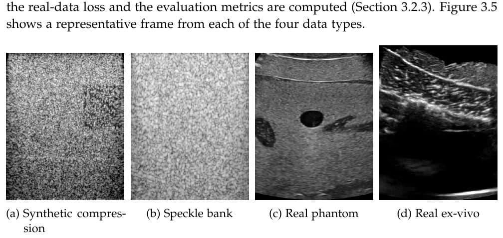 The four data types: synthetic compression, speckle bank, real phantom, and real ex-vivo tissue.