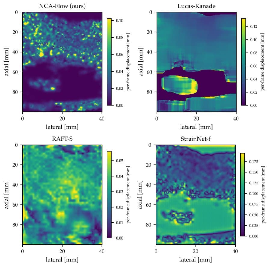 Per-frame displacement magnitude on one ex-vivo frame pair, one panel per method.
