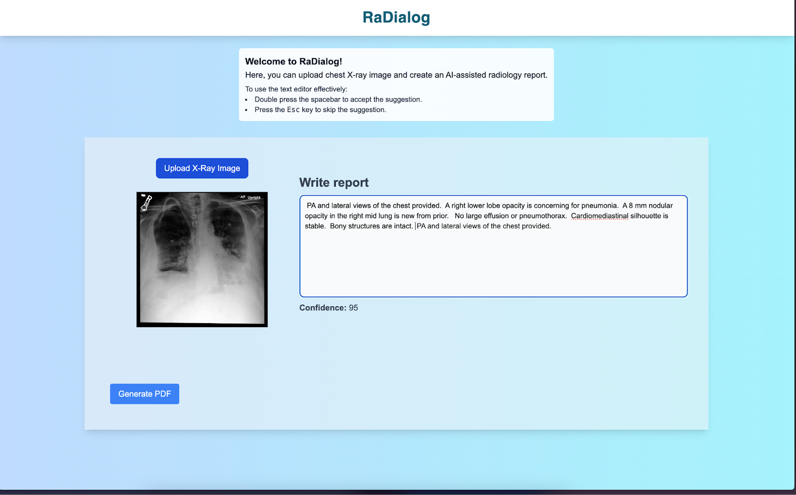 RaDialog Copilot Final Interface